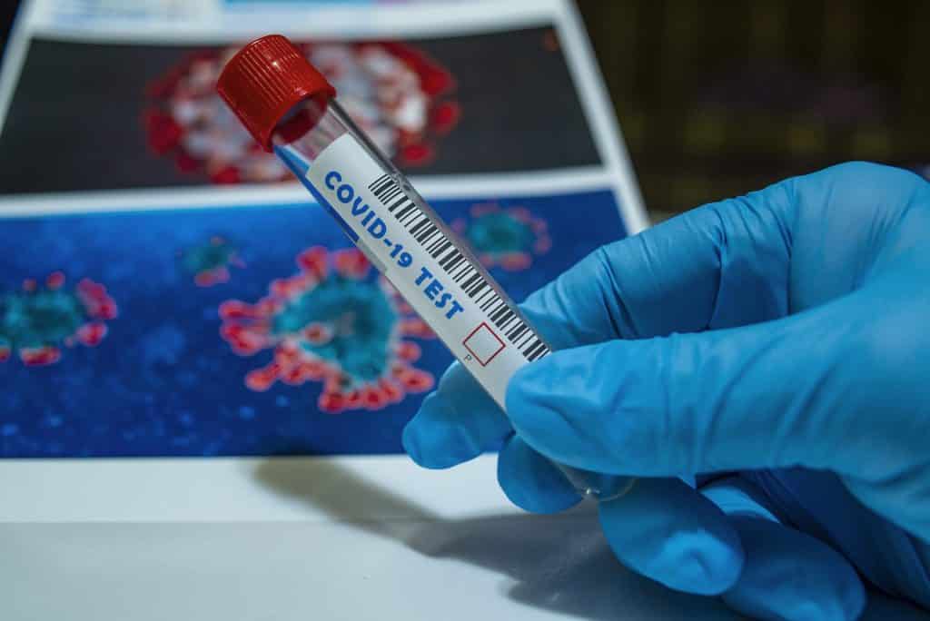 Both countries acted quickly against the Covid-19 pandemic. 